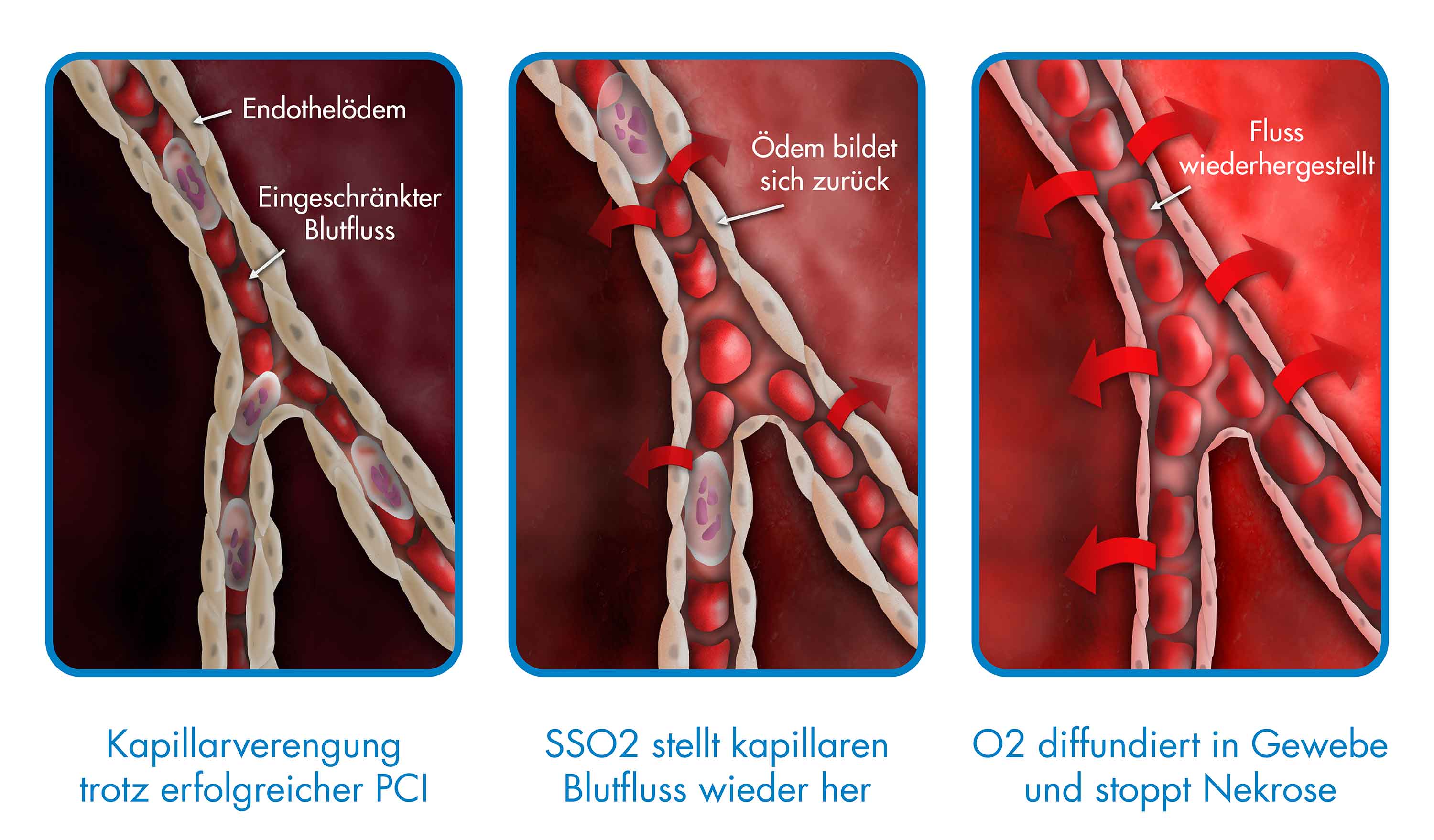 SSO2-Therapie – Dualer Wirkmechanismus