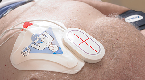 Electrodes and Internal Paddles