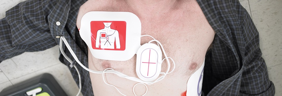 EMS Electrodes CPR