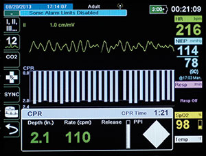 X Series CPR Dashboard screen