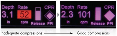 Inadequate versus good compressions on the X Series and R Series