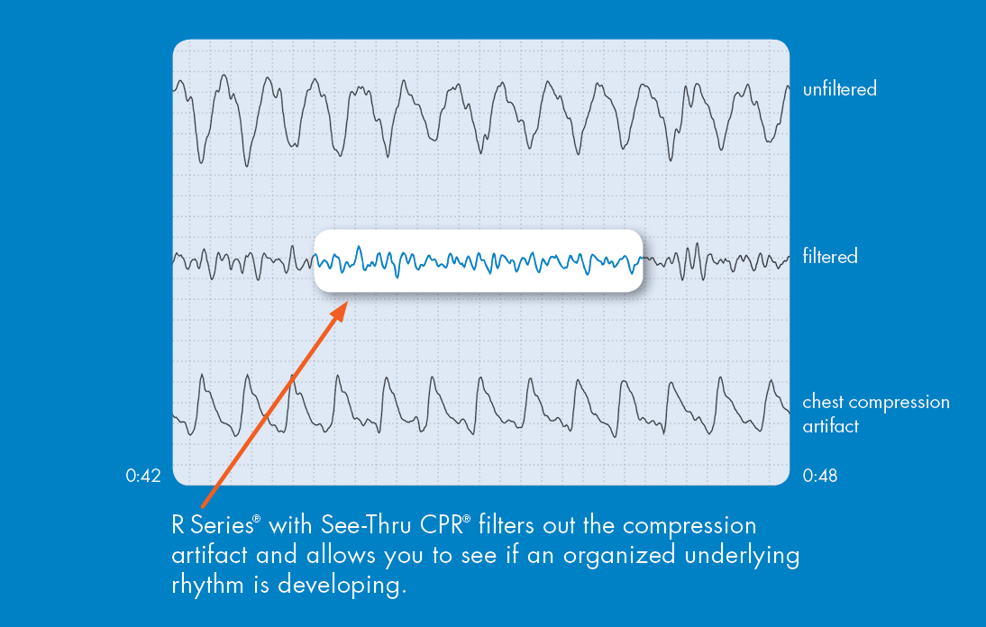 See-thru CPR waveform Hi Res
