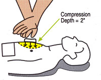 CPR-compressies